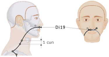 Dickdarmmeridian - Di19