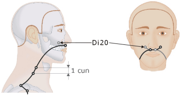 Dickdarmmeridian - Di20